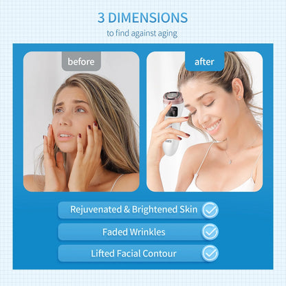 LyLy face lifting